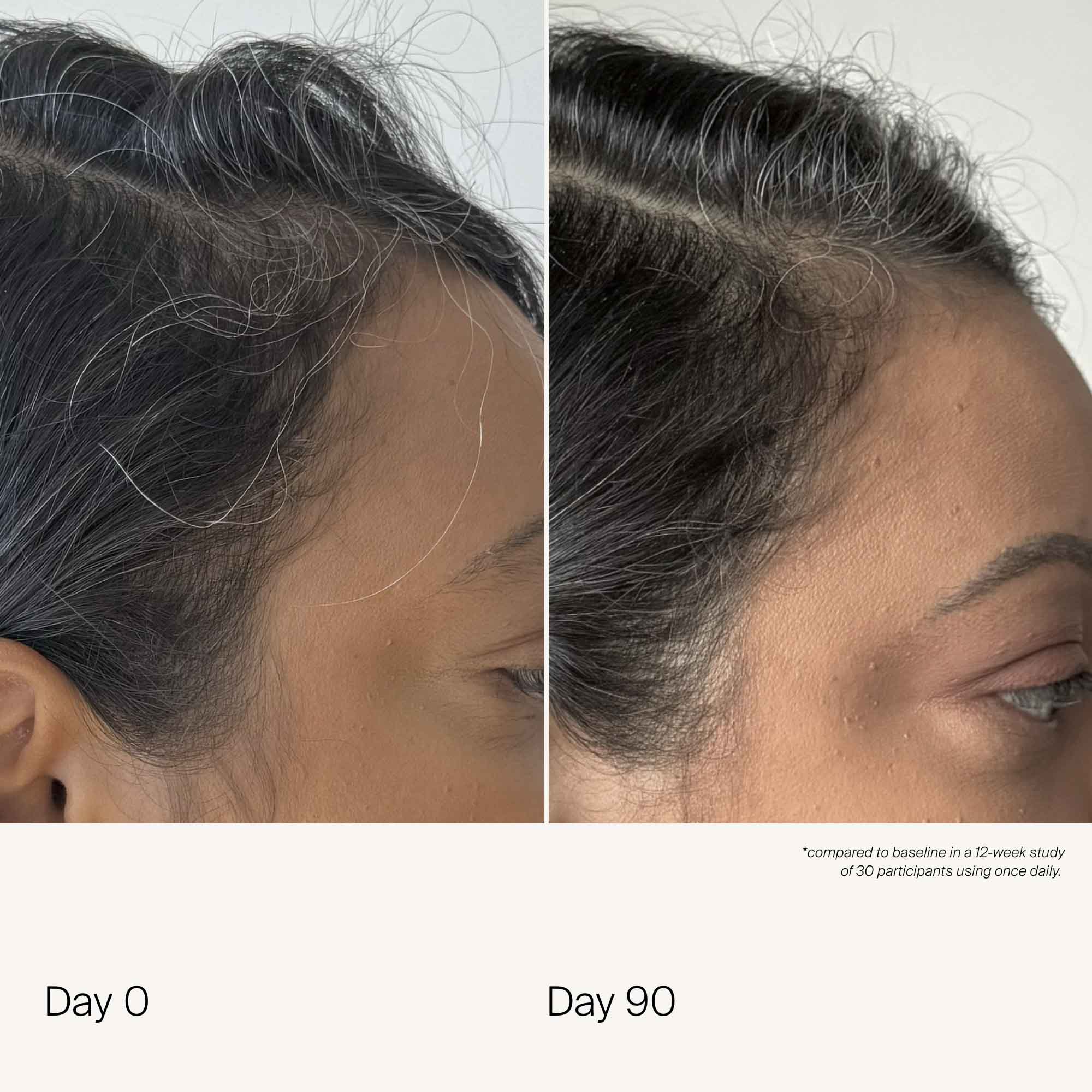 Scalp Care Density Serum 2-Pack - Image 4